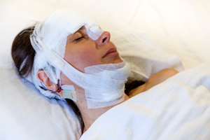 Concussions and Brain Injuries After a Car Accident