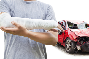 Broken Bones After a Car Accident